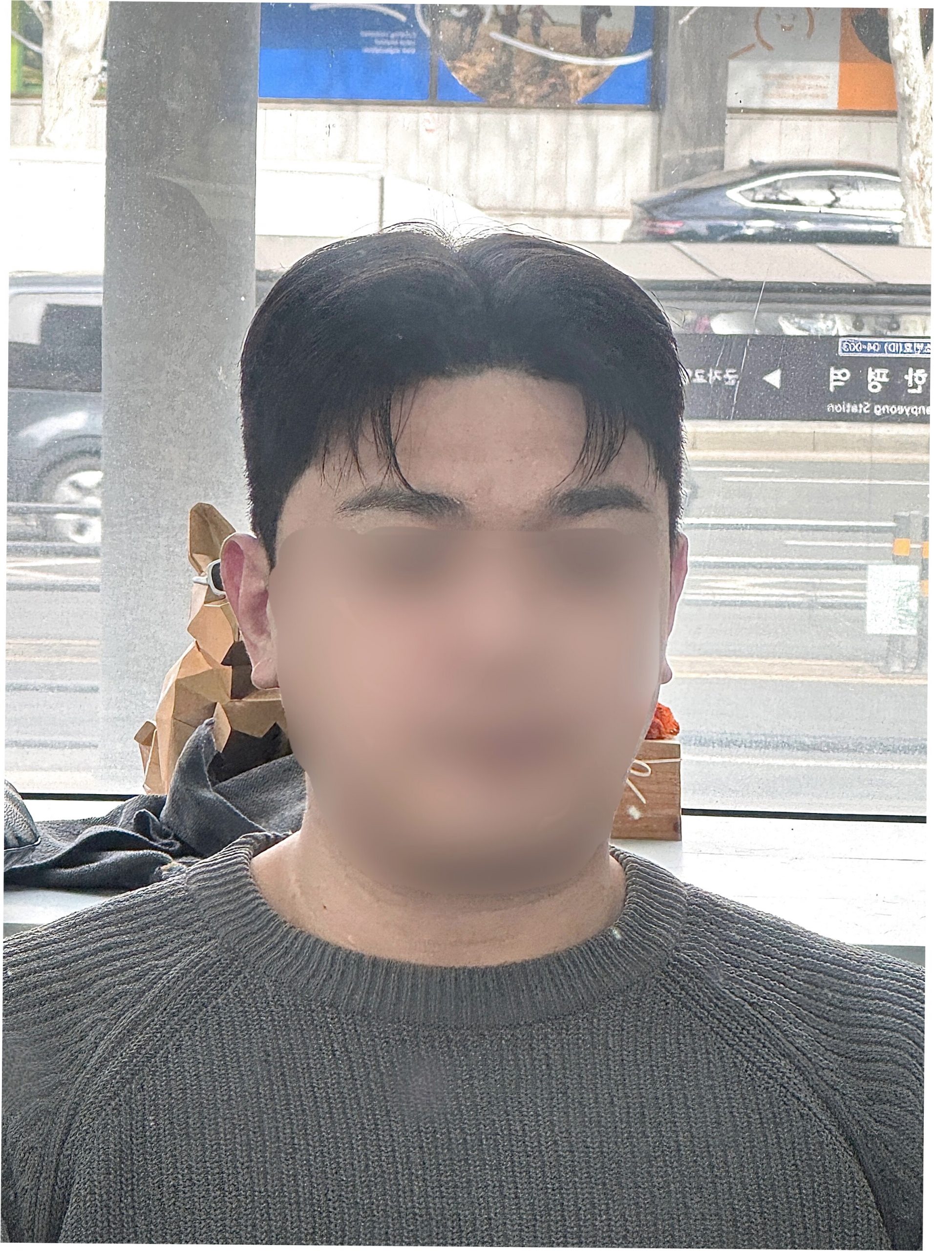 남자 리프펌 시술 과정